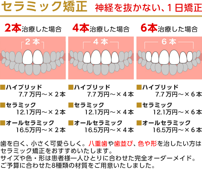 セラミック矯正料金表